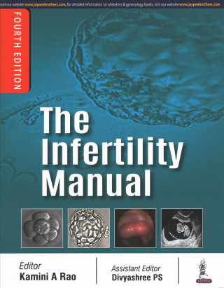 Carte Infertility Manual Kamini A Rao