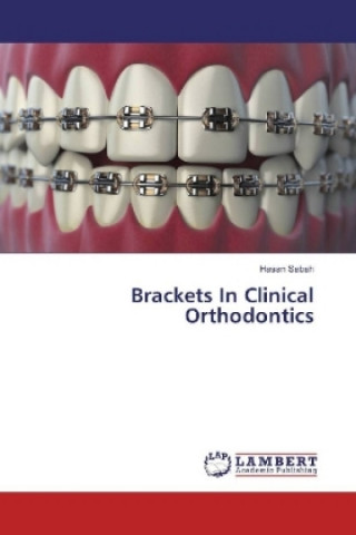 Carte Brackets In Clinical Orthodontics Hasan Sabah