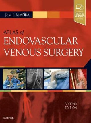 Книга Atlas of Endovascular Venous Surgery Almeida
