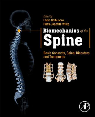 Kniha Biomechanics of the Spine Fabio Galbusera