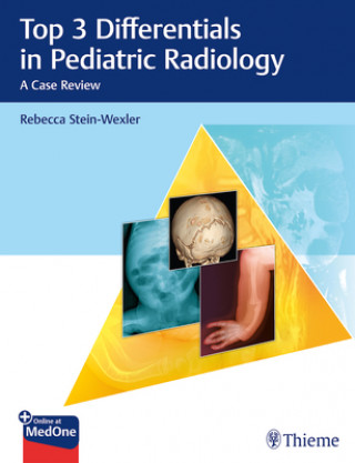 Könyv Top 3 Differentials in Pediatric Radiology Rebecca Stein-Wexler