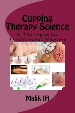 Kniha Cupping Therapy Science: A Therapeutic Traditional Regime Malik Ih
