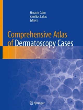 Könyv Comprehensive Atlas of Dermatoscopy Cases Horacio Cabo