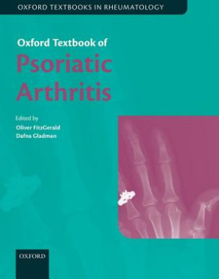 Kniha Oxford Textbook of Psoriatic Arthritis Oliver FitzGerald