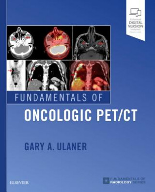 Kniha Fundamentals of Oncologic PET/CT Ulaner