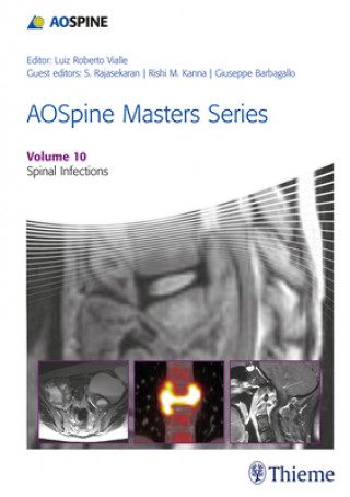 Książka AOSpine Masters Series, Volume 10: Spinal Infections Giuseppe MV Barbagallo