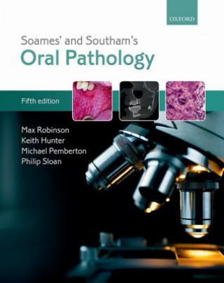 Könyv Soames' & Southam's Oral Pathology Robinson