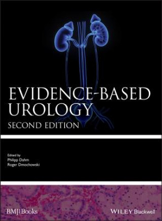 Książka Evidence-based Urology Philipp Dahm