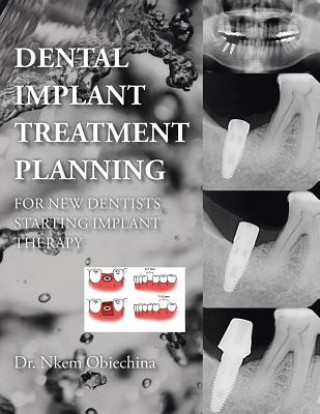 Kniha Dental Implant Treatment Planning for New Dentists Starting Implant Therapy Dr Nkem Obiechina