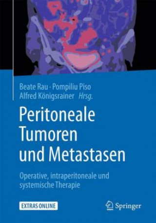 Kniha Peritoneale Tumoren und Metastasen Beate Rau