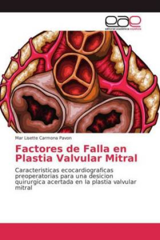 Kniha Factores de Falla en Plastia Valvular Mitral Mar Lisette Carmona Pavon