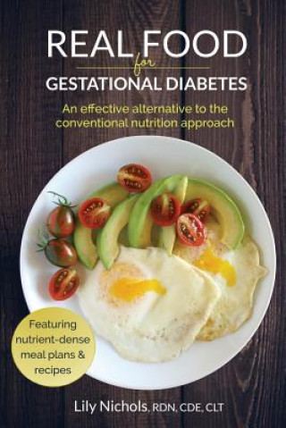 Książka Real Food for Gestational Diabetes Lily Nichols