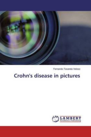Könyv Crohn's disease in pictures Fernando Tavarela Veloso
