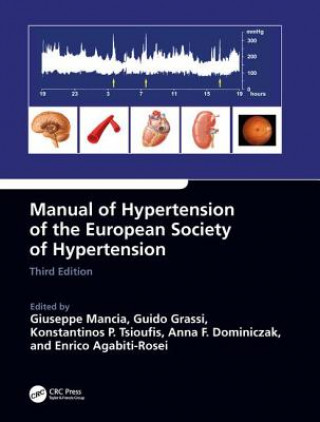 Knjiga Manual of Hypertension of the European Society of Hypertension Giuseppe Mancia