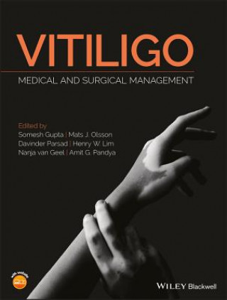 Книга Vitiligo - Medical and Surgical Management Somesh Gupta