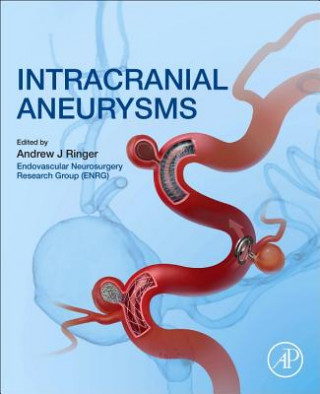 Книга Intracranial Aneurysms Andrew Ringer