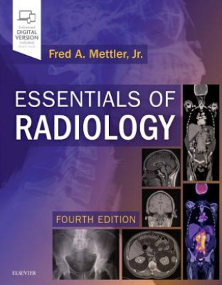 Könyv Essentials of Radiology Fred A. Mettler