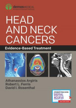 Kniha Head and Neck Cancers Athanassios Argiris