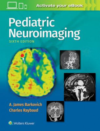 Kniha Pediatric Neuroimaging Barkovich