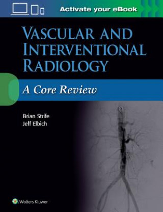 Knjiga Vascular and Interventional Radiology: A Core Review Strife