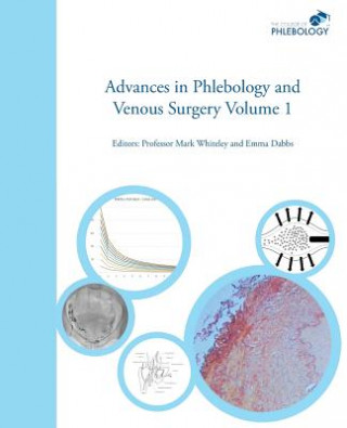 Книга Advances in Phlebology and Venous Surgery - Volume 1 Emma Dabbs