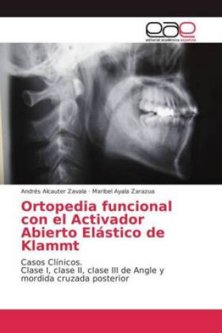 Kniha Ortopedia funcional con el Activador Abierto Elastico de Klammt Andrés Alcauter Zavala