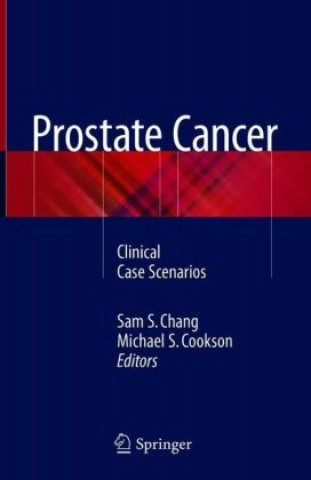 Carte Prostate Cancer Sam S. Chang