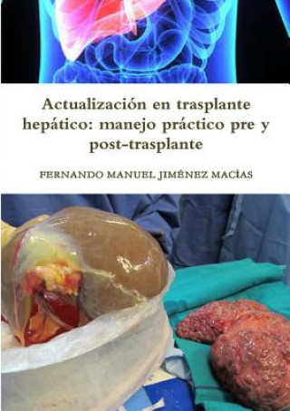 Kniha Actualizacion en trasplante hepatico FERN JIM NEZ MAC AS