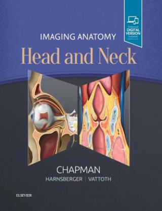 Carte Imaging Anatomy: Head and Neck Philip R Chapman