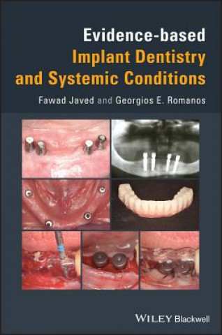 Könyv Evidence-based Implant Dentistry and Systemic Conditions Fawad Javed