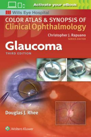 Книга Glaucoma Douglas Rhee