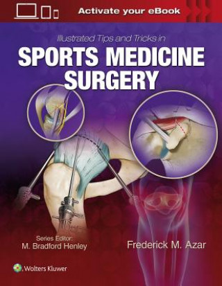 Carte Illustrated Tips and Tricks in Sports Medicine Surgery Frederick Azar