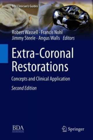 Kniha Extra-Coronal Restorations Robert Wassell