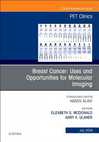 Kniha Breast Cancer: Uses and Opportunities for Molecular Imaging, An Issue of PET Clinics Mcdonald