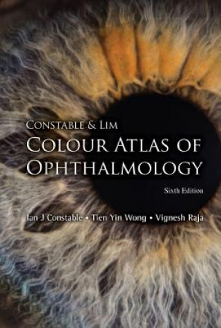 Carte Constable & Lim Colour Atlas Of Ophthalmology (Sixth Edition) Ian J Constable