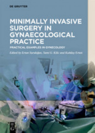 Kniha Minimally Invasive Surgery in Gynecological Practice Ertan Saridogan