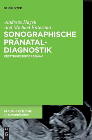 Kniha Sonographische Pranataldiagnostik Andreas Hagen