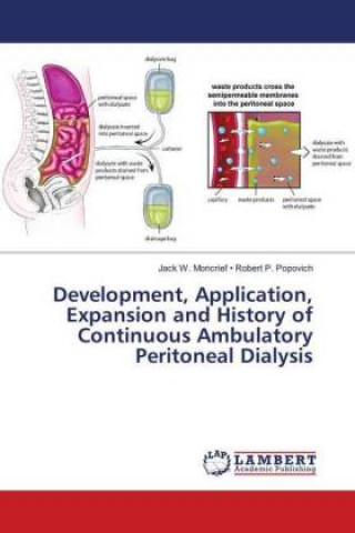 Könyv Development, Application, Expansion and History of Continuous Ambulatory Peritoneal Dialysis Jack W. Moncrief Robert P. Popovich
