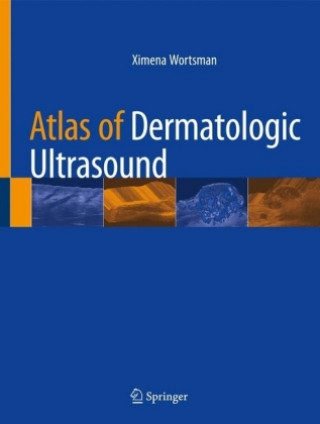 Könyv Atlas of Dermatologic Ultrasound Ximena Wortsman