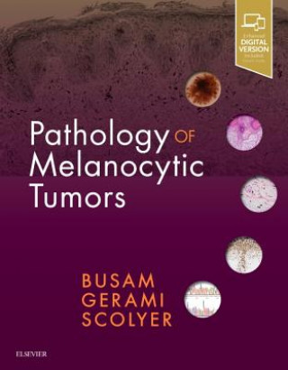 Kniha Pathology of Melanocytic Tumors Klaus J. Busam