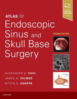 Książka Atlas of Endoscopic Sinus and Skull Base Surgery Alexander G. Chiu