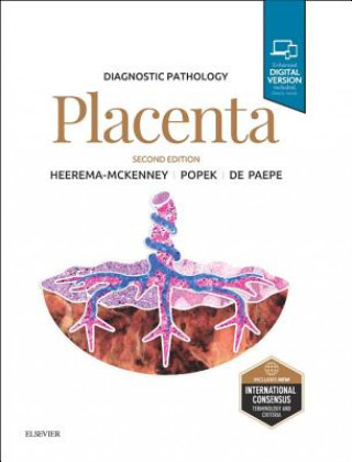Kniha Diagnostic Pathology: Placenta Amy Heerema-McKenney