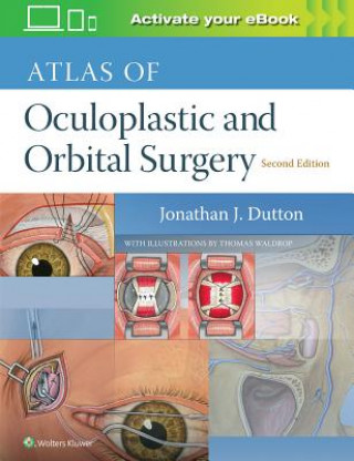 Książka Atlas of Oculoplastic and Orbital Surgery Dutton