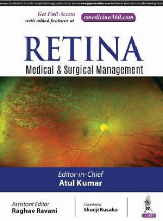 Book Retina Atul Kumar