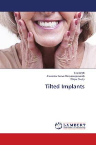 Book Tilted Implants Era Singh