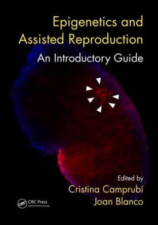 Carte Epigenetics and Assisted Reproduction 