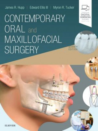 Książka Contemporary Oral and Maxillofacial Surgery James R. Hupp