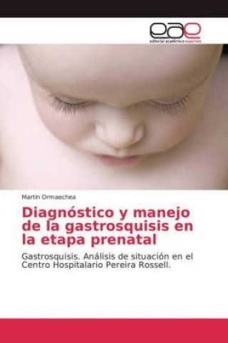 Könyv Diagnostico y manejo de la gastrosquisis en la etapa prenatal Martin Ormaechea