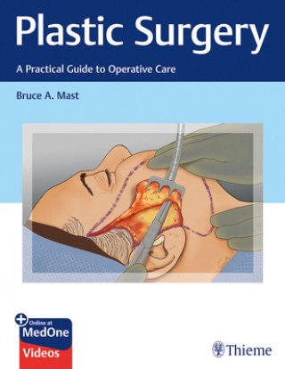 Kniha Plastic Surgery: A Practical Guide to Operative Care Bruce A. Mast