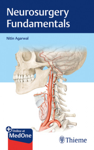 Könyv Neurosurgery Fundamentals Nitin Agarwal
